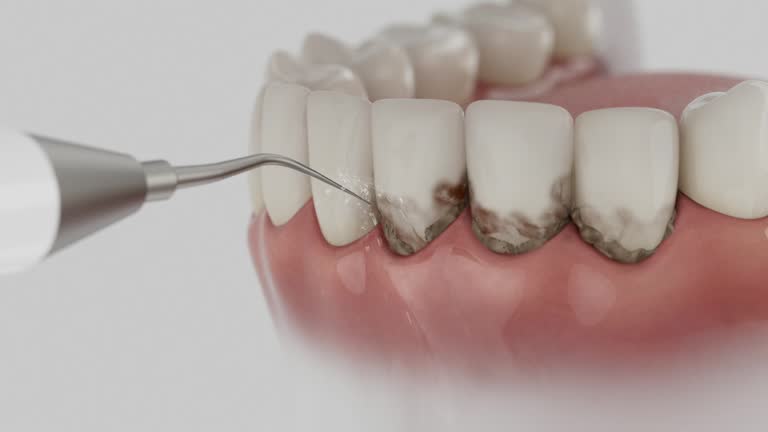 Reliable Root Canal Treatment contractor in Alleghany County County, NC by Dentist Open Now